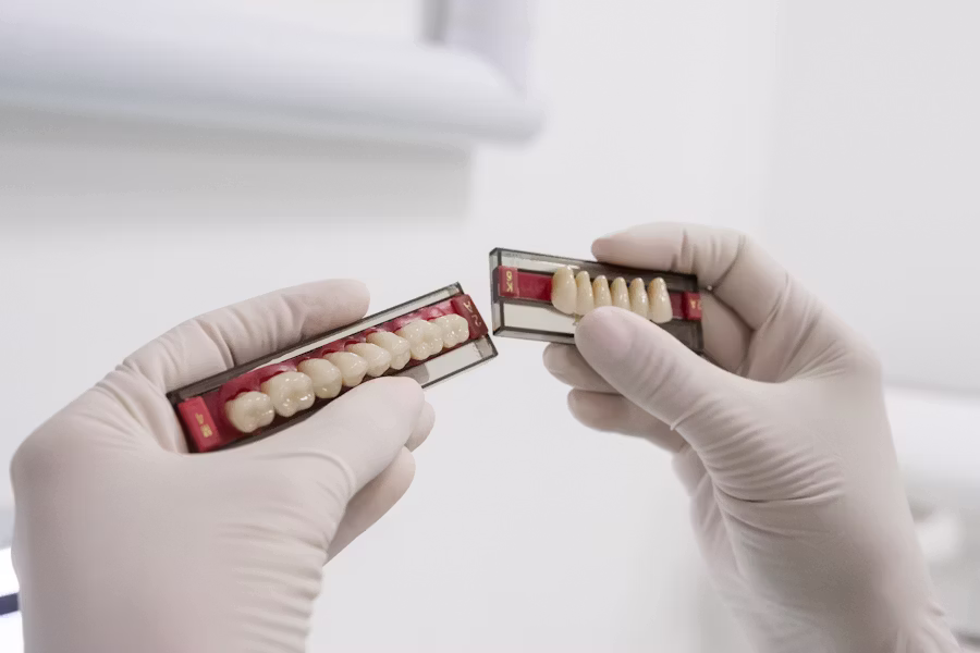 Cura dell'impianto dentale — Studio Dentistico Scacchetti