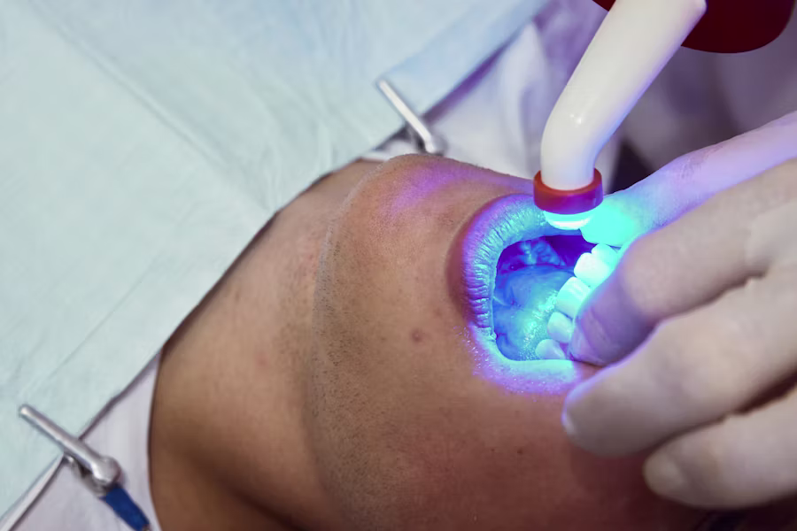Sbiancamento denti professionale in studio — Studio Dentistico Scacchetti