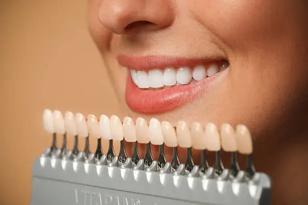 Sorriso perfetto con trattamenti di estetica dentale — Studio Dentistico Scacchetti